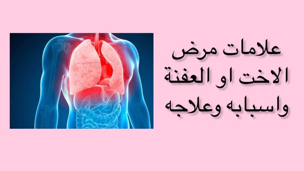 علاج العفنة بالعنزروت جابر القحطاني