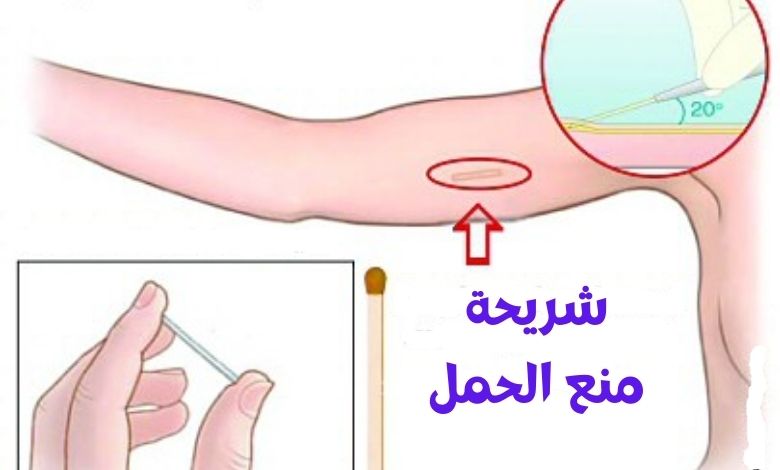 سعر شريحة منع الحمل في صيدلية الدواء