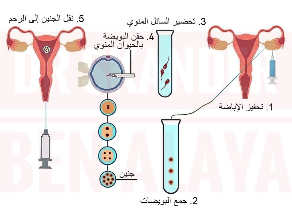 مين عملت تحديد نوع الجنين ونجحت