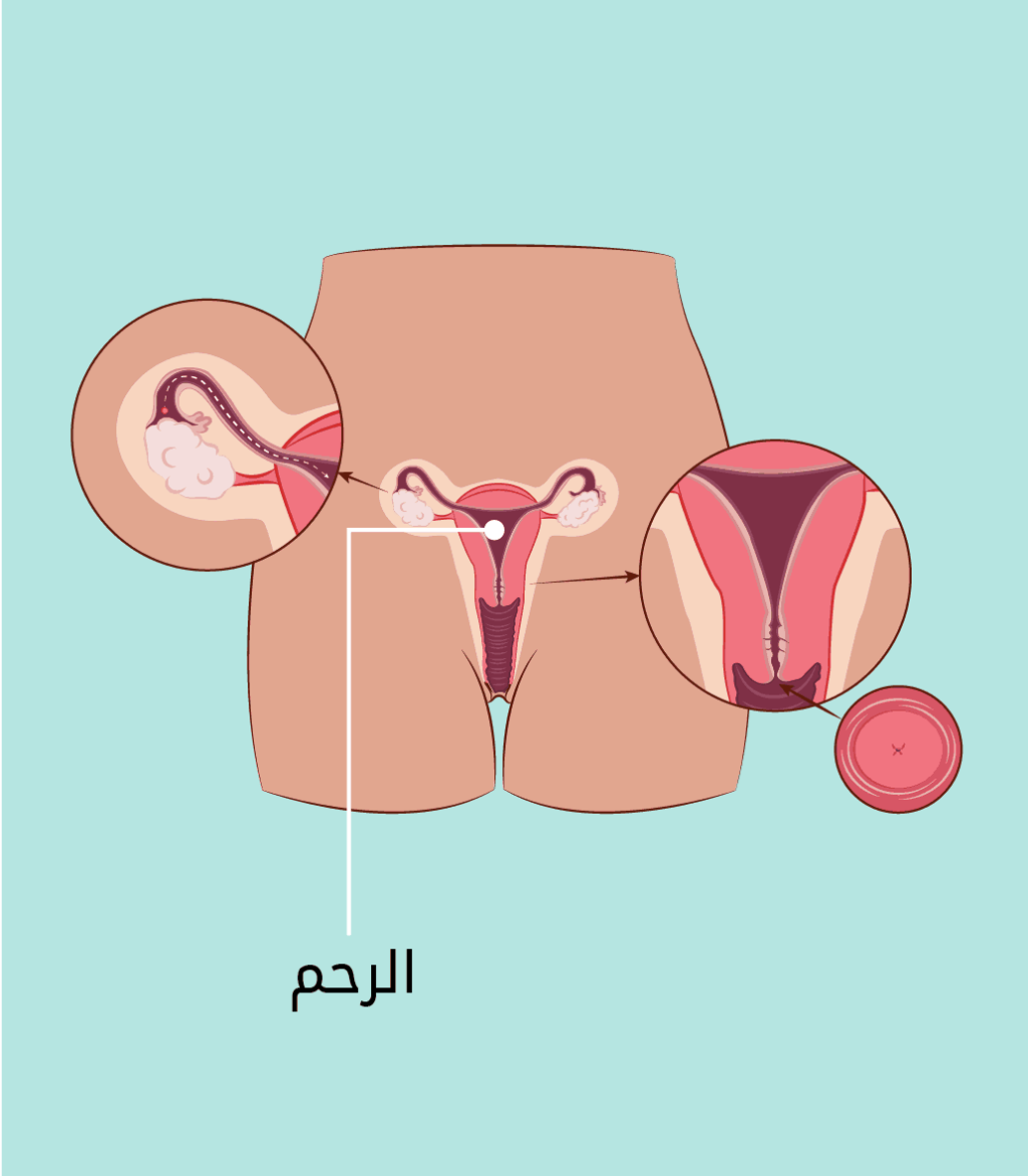 حكم حلق شعر الخصيتين