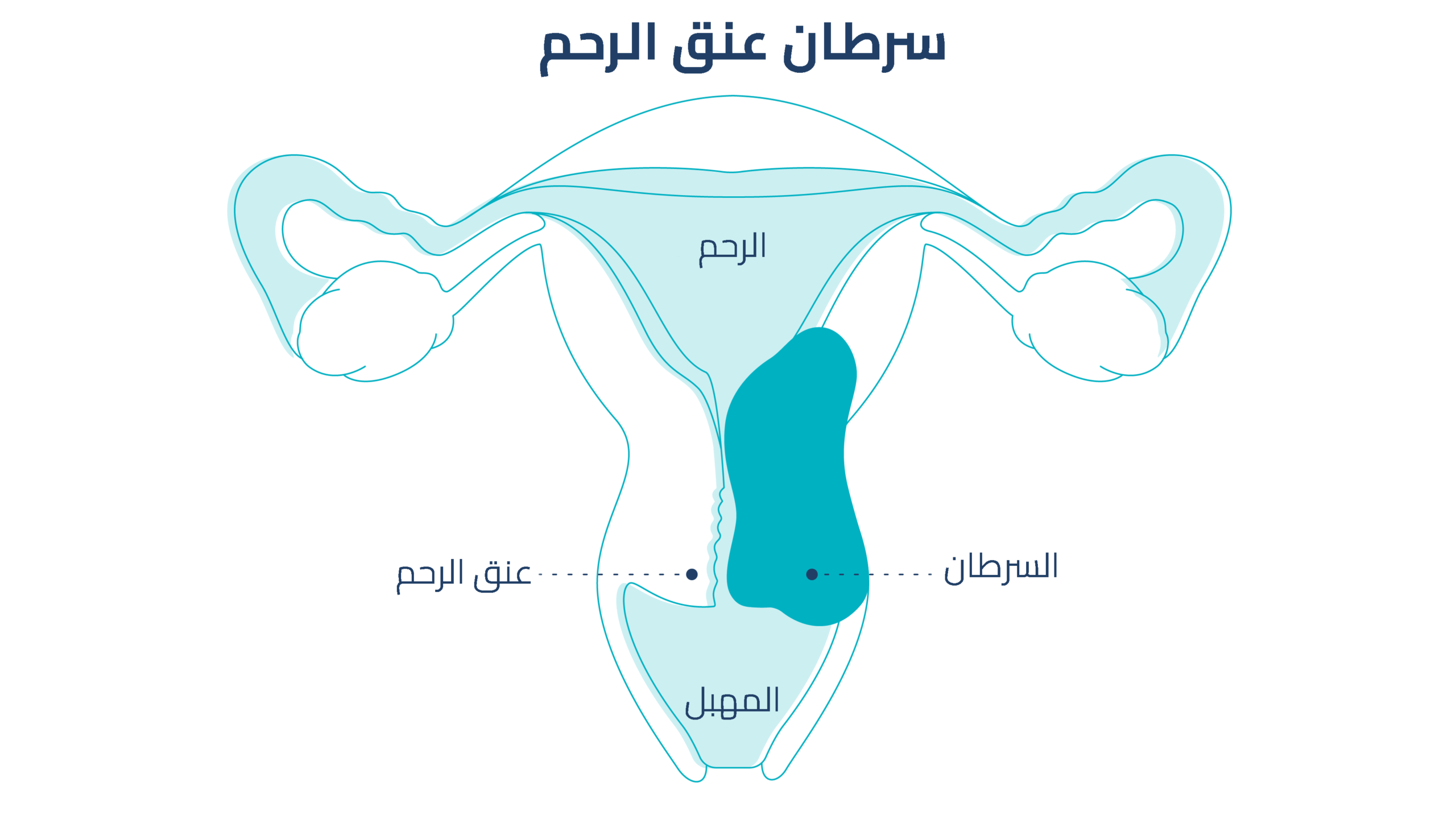 متى يرتفع عنق الرحم بعد الولادة