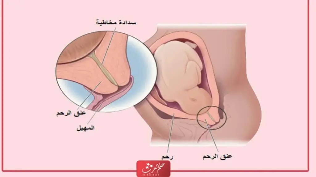 تسريع الولادة بعد نزول السدادة