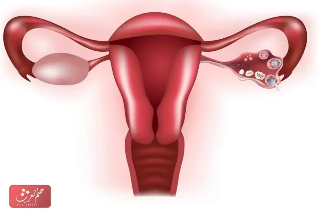 علاج تكيسات المبايض بالقران