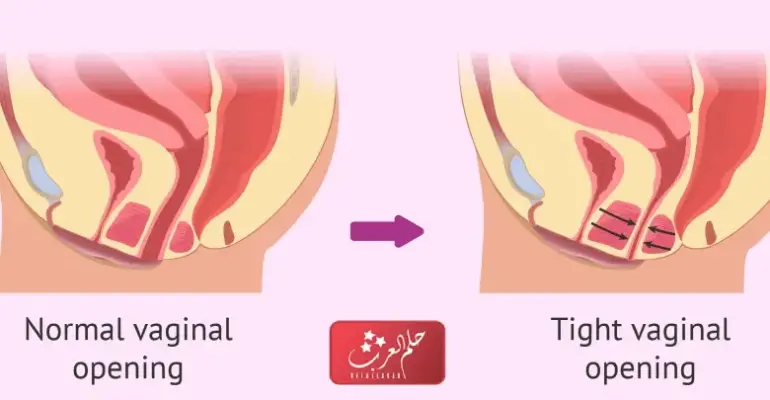 كيف اعرف ان المهبل ضيق؟