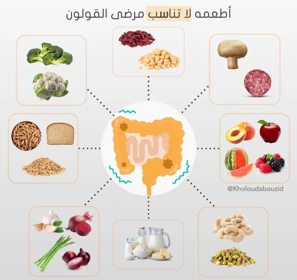 الأكلات الممنوعة لمرضى القولون العصبي