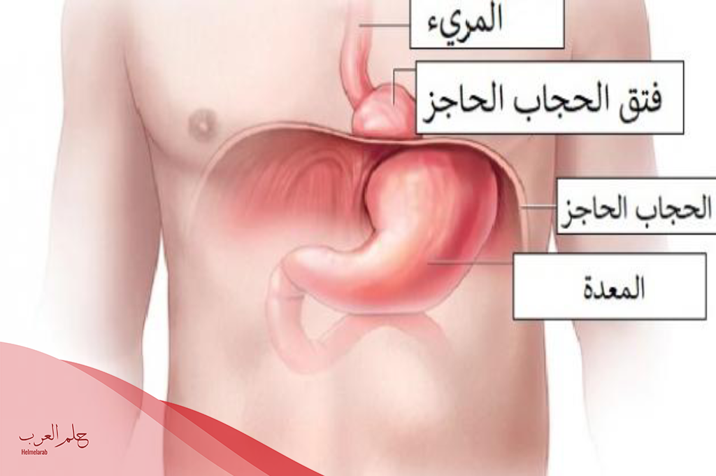 مضاعفات عملية فتق الحجاب الحاجز