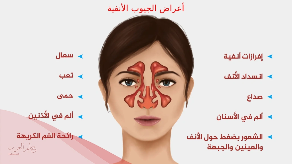 تجربتي مع عملية الجيوب الأنفية ونتائجها