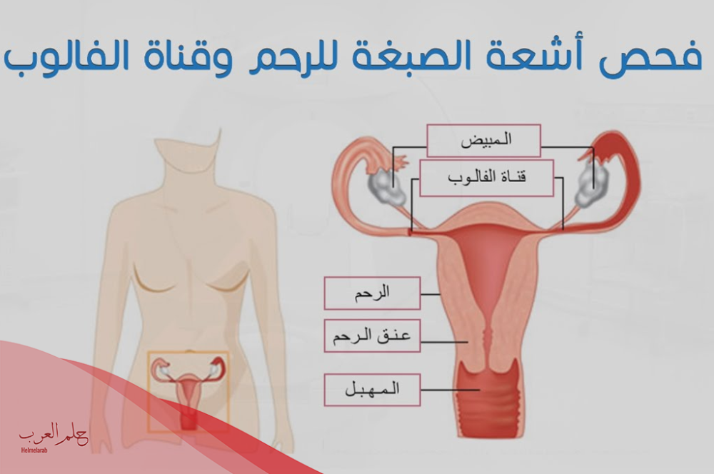 نسبة الحمل بعد اشعة الصبغة ومرحلة الفحص