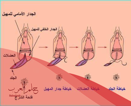 تجاربكم مع التمريخ للحمل