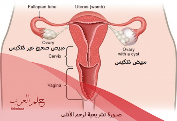 عدم نزول الدورة الشهرية مع وجود آلامها