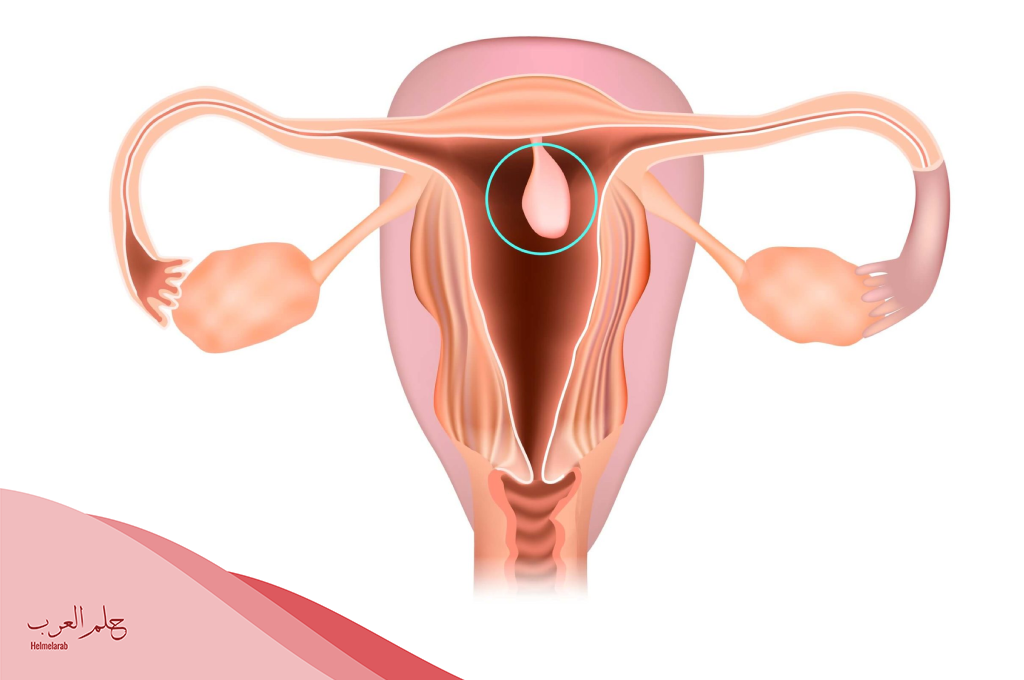 قطعة لحم داخل فتحة المهبل للمتزوجه