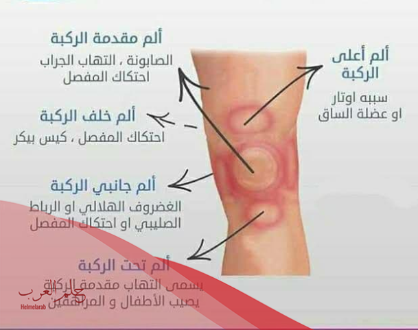 ماذا افعل عندما تؤلمني ركبتي؟