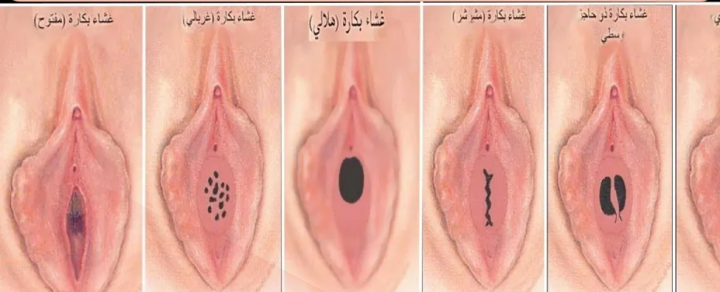 كيف اعرف اني عذراء