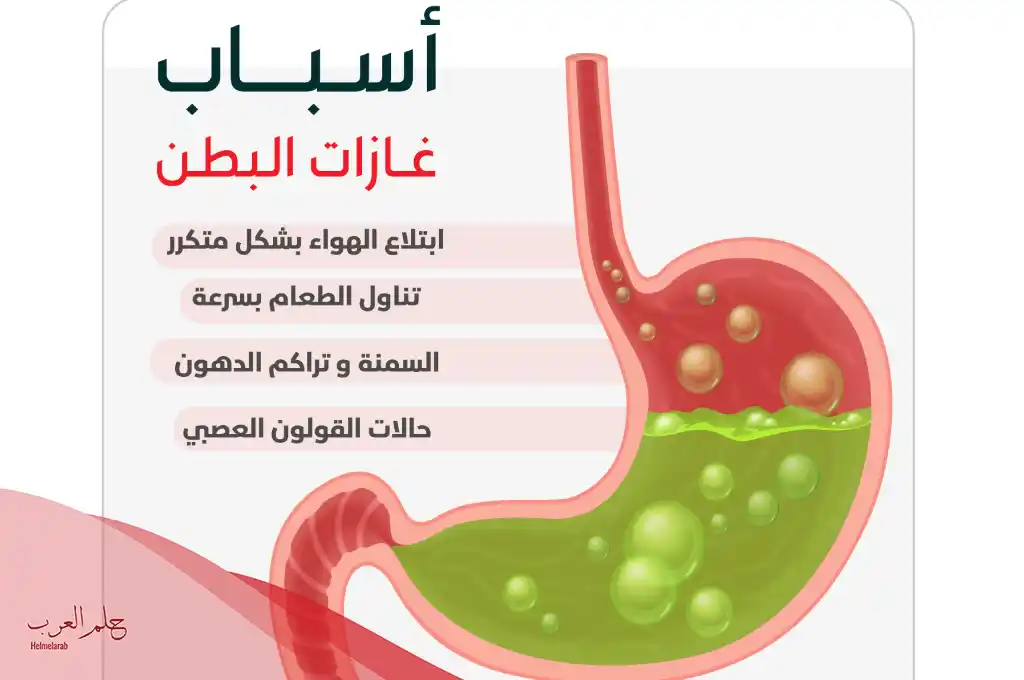 أسباب كثرة الغازات عند النساء