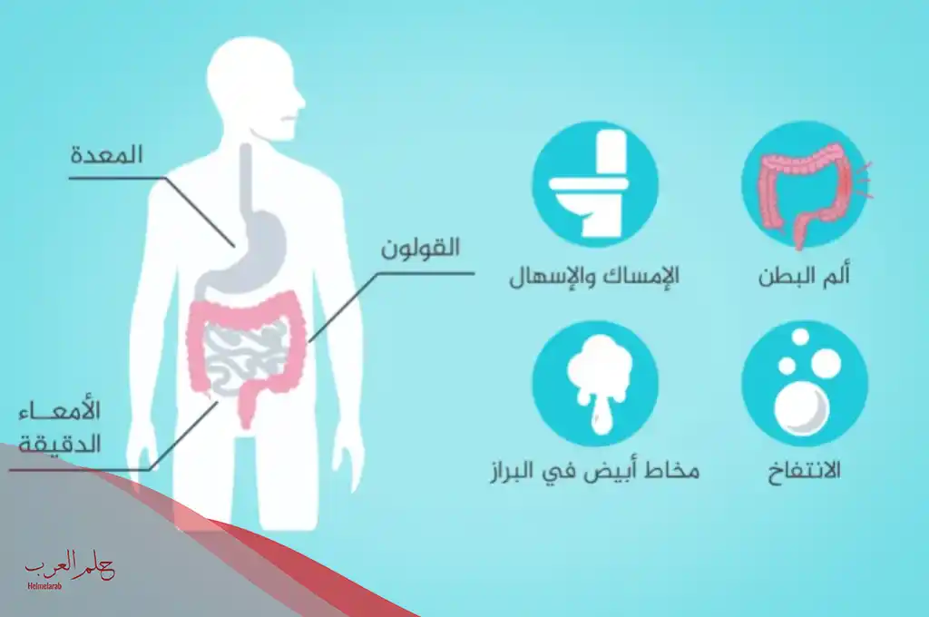 أعراض الخلعة في القولون العصبي