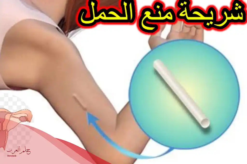 هل شريحة منع الحمل تزيد الوزن